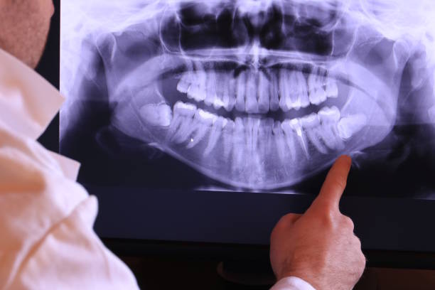 Best Pediatric Emergency Dentist in Jones Valley, CA