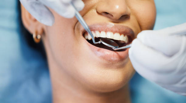 Best Emergency Root Canal Treatment in Jones Valley, CA