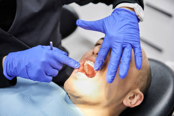 Best After-Hours Dental Trauma Care in Jones Valley, CA